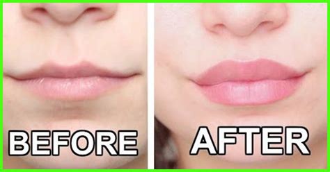 best lip plumper for aging lips.